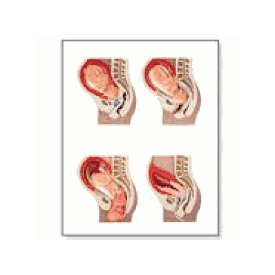 Childbirth Process Chart without rods