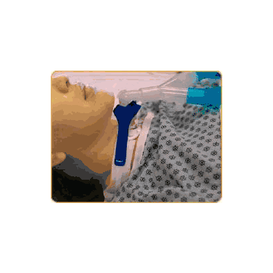 Circuit, Vent Ped Anti Disconnect (10/Bx) -