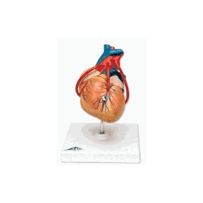 Classic Heart with Bypass