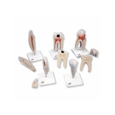 Classic Tooth Model Series, 5 Model