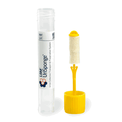 Copan 8C023S01.A Urine Specimen Collection, 12 x 80 mm Tube Size