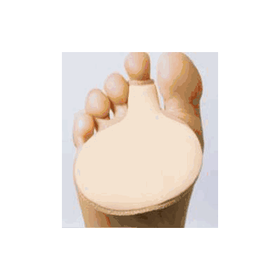 Cushion, Metatarsal Dlx Nylon Lg - - Pedifix