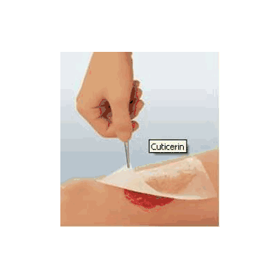 Cuticerin Impregnated Dressing Gauze 20 X 40