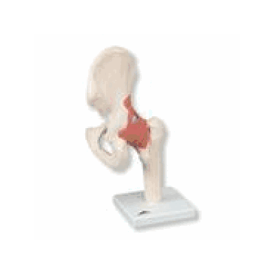 Deluxe Functional Hip Joint Model