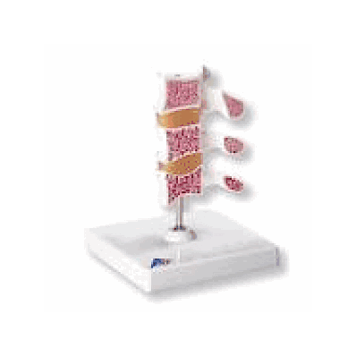 Deluxe Osteoporosis Model (3 Vertebrae)