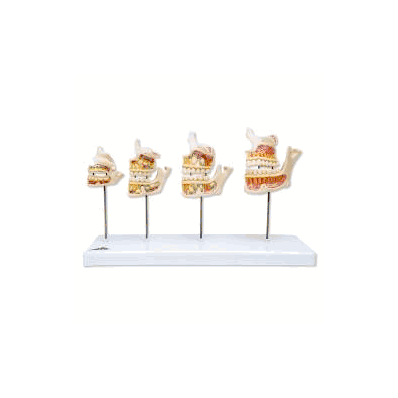 Dentition Development Dental Model
