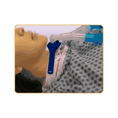 Device, Ventilator, Anti-disconnect, Adult