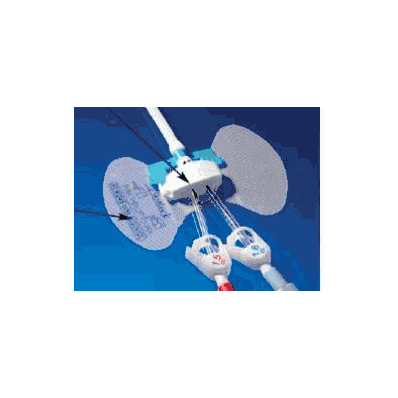 Dialysis Catheter Stabilization Device Statlo