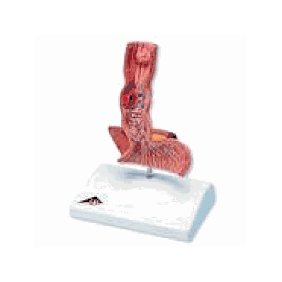 Diseases of the Esophagus