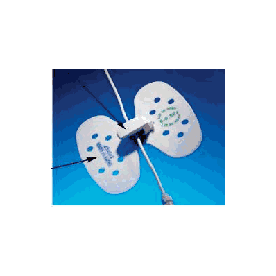 Drainage Catheter Stabilization Device Statlo