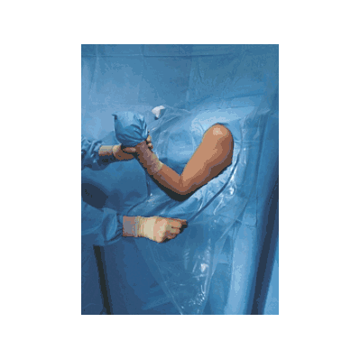 Drape, Shoulder, Arthro, Beach Chair, Ster -