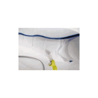 Dvt Compression Therapy Wrap 1 Chamber Nxstar