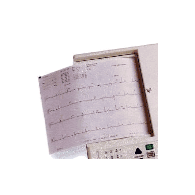 Ecg / Eeg Recording Paper Thermal 8-1/2 X 11