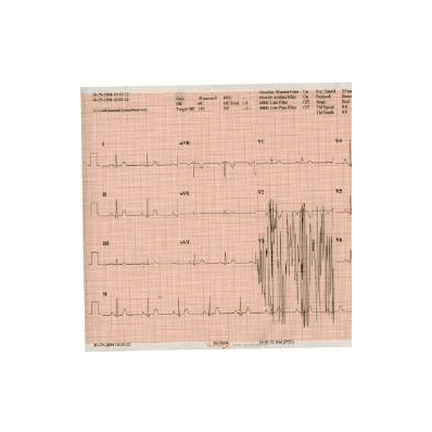 Ecg Recording Paper - Paper, Treadmill F/1841