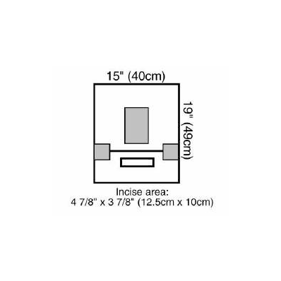 Eent Drape 3m Steri-drape Incise Drape 15 W