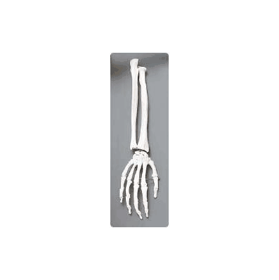 Elbow Model - Model, Elbow - Sammons Preston