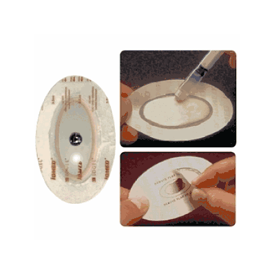 Electrodes, Iogel, Small - Medline