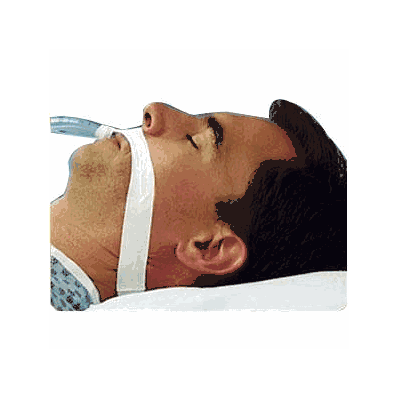 Endotrach Tape, Pediatric/Small, Cloth 100/Cs #305B