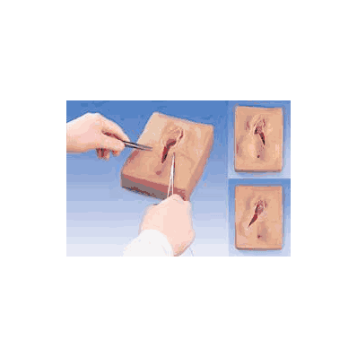 Episiotomy Suturing Simulator, Set of 3