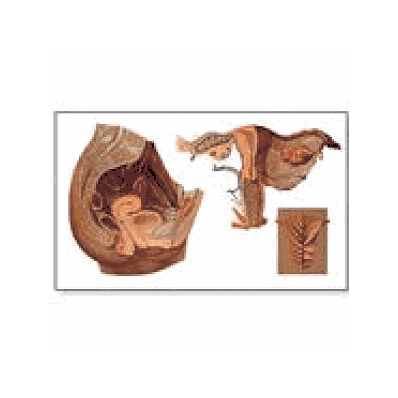 Female Pelvic Chart with wooden rods