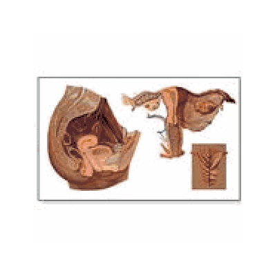 Female Pelvic Chart without rods
