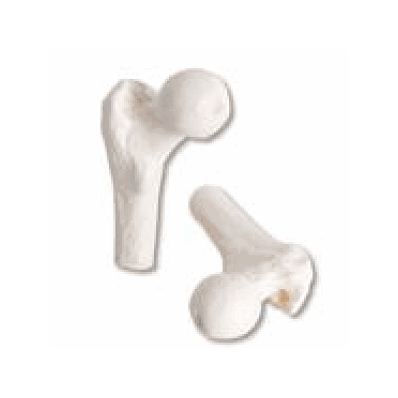 Femur Heads, 1 Pair