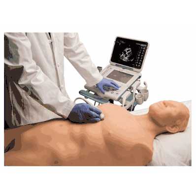 Focus Assess with Sonography Trauma