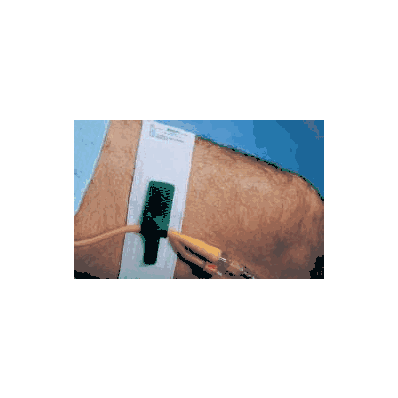 Foley Catheter Holder Hold-n-place Fit Up To