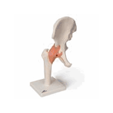 Functional Hip Joint