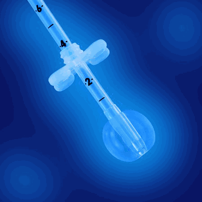 Gastrostomy Feeding Tube, 24 Fr., 7-10 mL Balloon