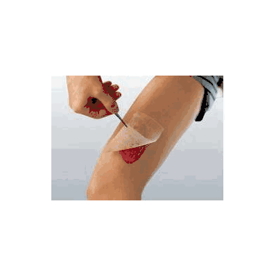 Gauze Dressing Cuticerin 3 X 3 Inch - Dressin