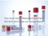 Greiner 455010P, Red/Yellow Ring 16 x 100 mm Venous Blood Collection Tube, 9 mL Serum Clear PET Tube, Pull Cap, Sterile, sold as 50/pk, 24 pk/cs <br><br><font color="red"><b>BACK TO THE PRODUCT TABLE, <a href="https://www.aaawholesalecompany.com/clinical-laboratory-laboratory-glassware-and-plasticware-greiner-red-yellow-ring-venous-blood-collec.html">CLICK HERE</a></b></font>