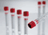 Greiner 456073P, Red/Yellow Ring 13 x 100 mm, 5 mL Serum Clear PET Tube, Pull Cap, Venous Blood Collection Tube, Sterile, sold as 50/pk, 24 pk/cs<br><br><font color="red"><b>BACK TO THE PRODUCT TABLE, <a href="https://www.aaawholesalecompany.com/clinical-laboratory-laboratory-glassware-and-plasticware-greiner-red-yellow-ring-venous-blood-collec.html">CLICK HERE</a></b></font>