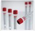 Greiner 456292P, Red / Yellow Ring Cap 	13 X 100 mm, Venous Blood Collection Tube, 	Clot Activator / Separator Gel Additive, Silica Coated Pull Cap, 4 mL Clear Serum Tube, Sterile, sold as 50/Box<br><br><font color="red"><b>BACK TO THE PRODUCT TABLE, <a href="https://www.aaawholesalecompany.com/clinical-laboratory-laboratory-glassware-and-plasticware-greiner-red-yellow-ring-venous-blood-collec.html">CLICK HERE</a></b></font>