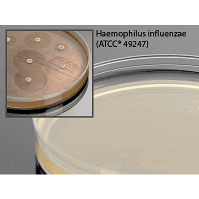 Haemophilus Test Medium Agar, 15 X 100 mm, For Susceptibility Testing
