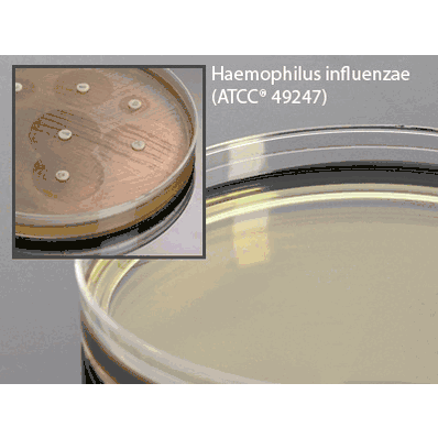Haemophilus Test Medium Agar, 15 x 50 mm For Susceptibility Testing