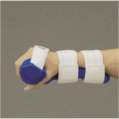 Hand splint for right hand, inflatable