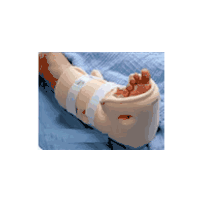 Heel Protector Boot Heelift Regular Beige -