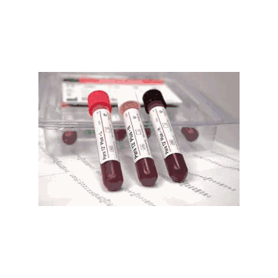 Hematology Control, 12 x 3 mL for CELL-DYN