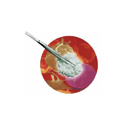 Hemostatic Sponge, 1/2" x 1" Rectangle Collagen
