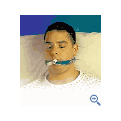 Holder, Tube, Endotrach, Secure Easy