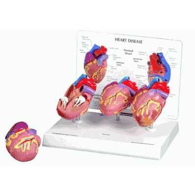 Human Heart Model, Mini-Heart Set, 3-one ha