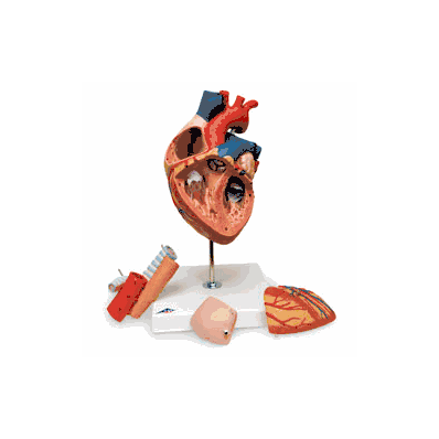 Human Heart Model, with Esophagus and Trach
