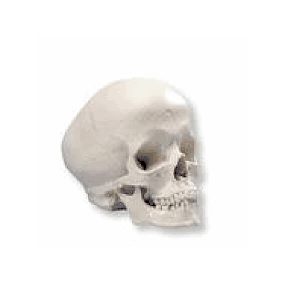 Hydrocephalic Human Skull Model