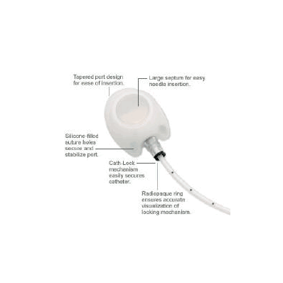 Implanted Port, 8 Fr. Single Lumen