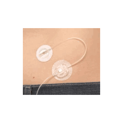 Infusion Set, Sure T W/23" Tu 8mm (10/Bx) -