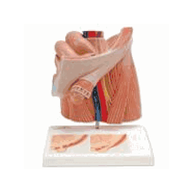 Inguinal Hernia Model