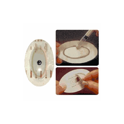 Iogel Iontophoresis Electrode Iontophoresis