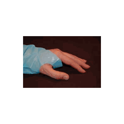 Isolation Gown X-large Blue - Gown, Iso Thumb