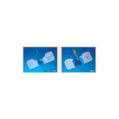 Iv Select Kit, Std Bore 6" W/Smart Y Vlv (25/